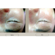 Whitening Spot Cream - 25g