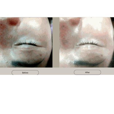 Whitening Spot Cream - 25g