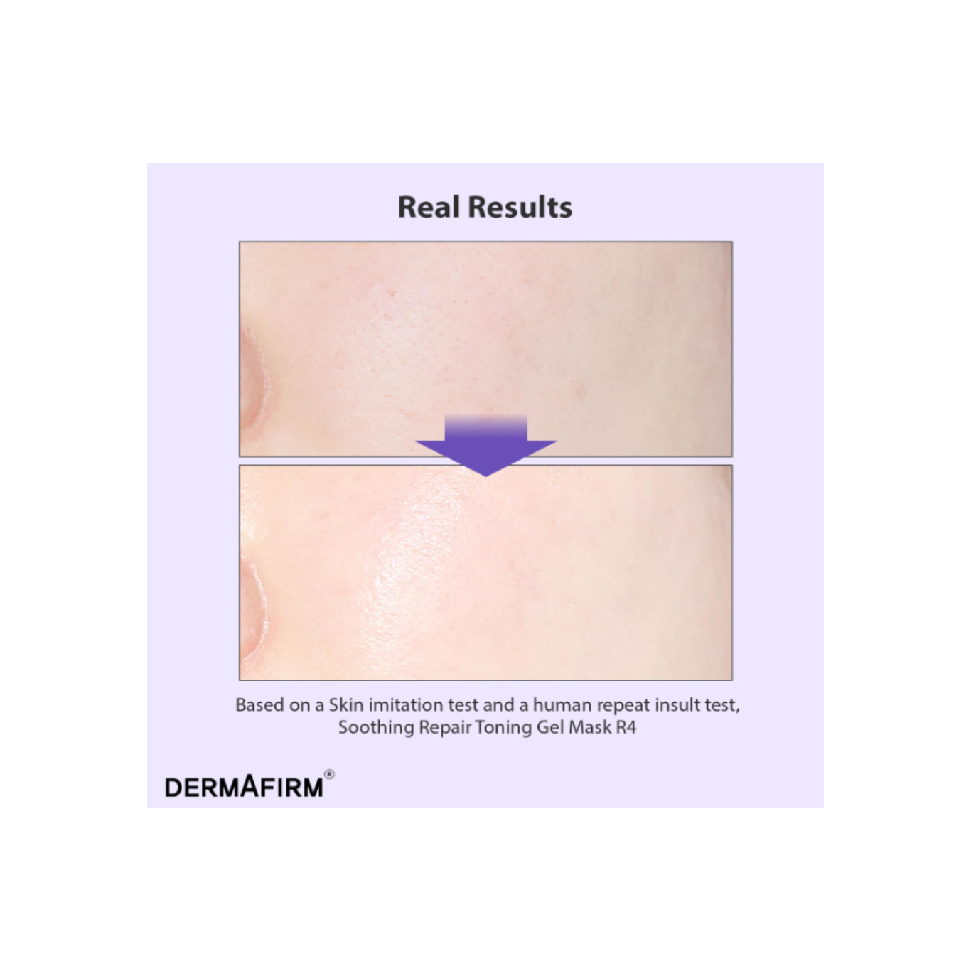 Soothing Repair Toning Gel Mask R4 (34g x 4 pcs)