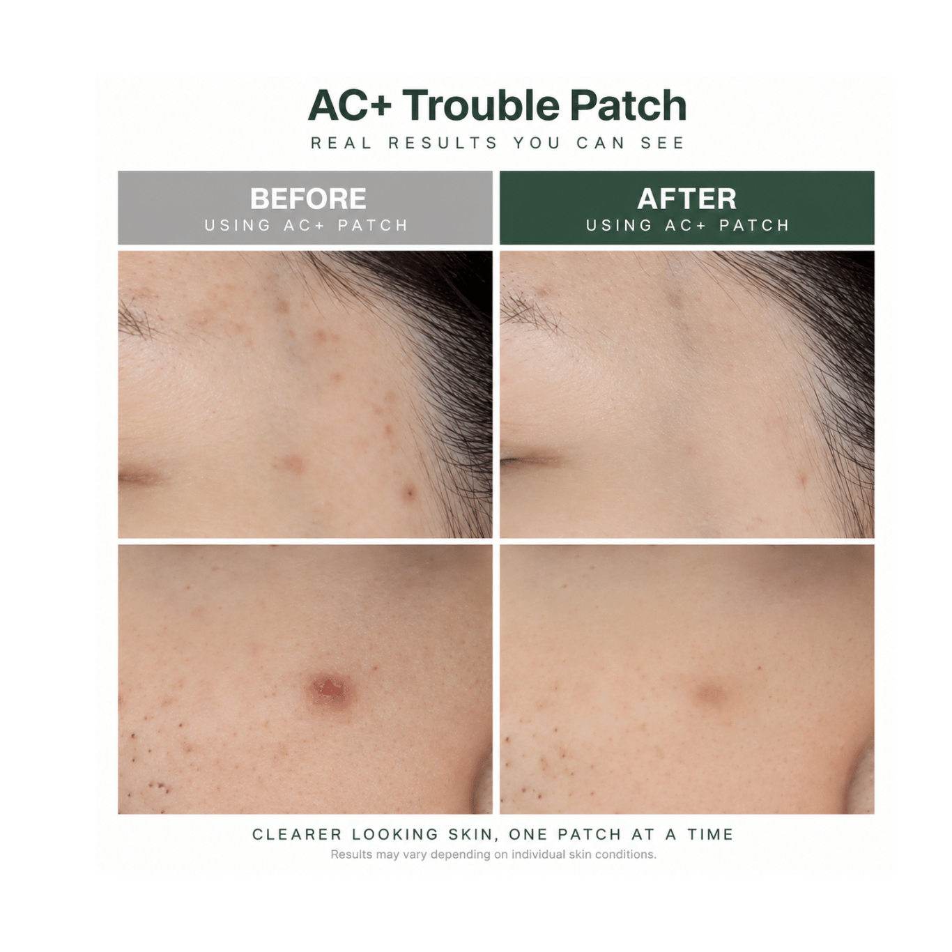 AC+ Trouble Patch -56 pcs x 2 packs