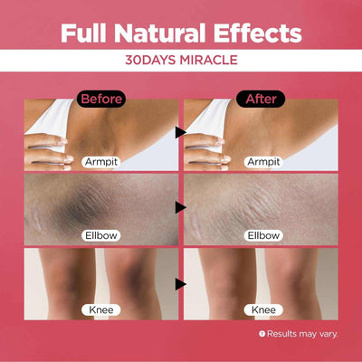 Dark Spot Corrector Cream - 50ml