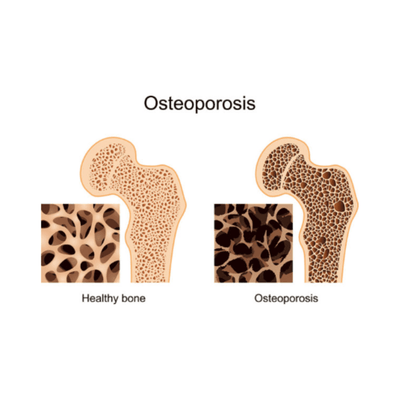 APEXEL - Nanotechnology Enabled Calcium (230mg x 120 Capsules)