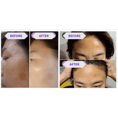 APEXEL Nanotechnology - Miracle Bar (65g - 1 Bar)