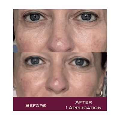 BDR - Rosa Calm - Capillary Relief Ampoule