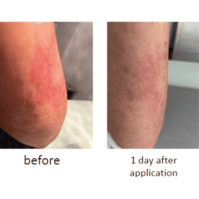 BDR - SOS Boswellia – Skin Defense Ampoule