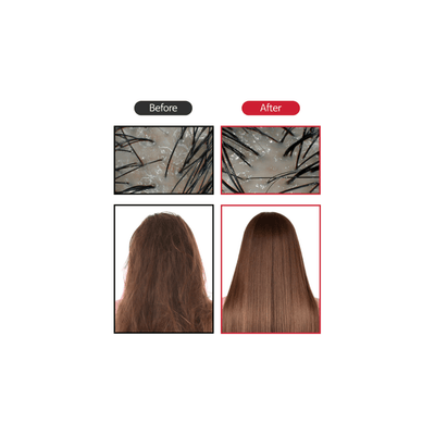 BIOTOC Boosting Gro Serum for Hair (formerly M&O) - 100ml