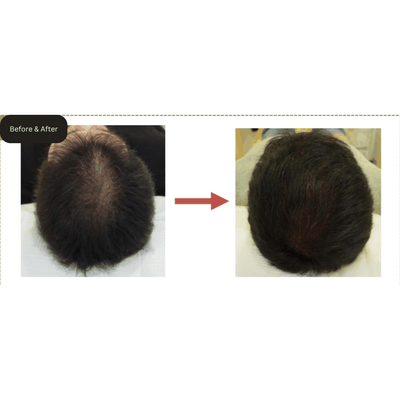 BIOTOC Boosting Gro Serum for Hair (formerly M&O) - 100ml