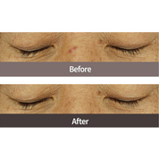 Wonder Eyelash Serum - 8ml