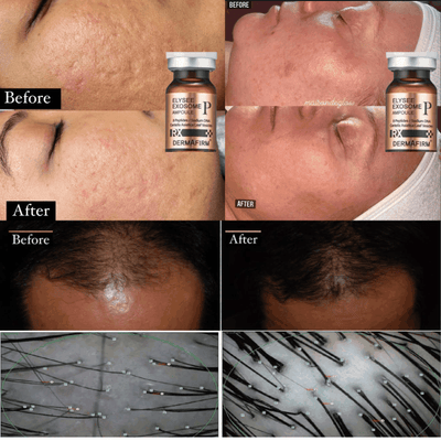 CODE-X Microneedling Pen - Optimized for Precision, Performance & Safety