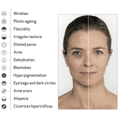 Rx Elysee Exosome PDRN Ampoule (4ml x 12) Bundle