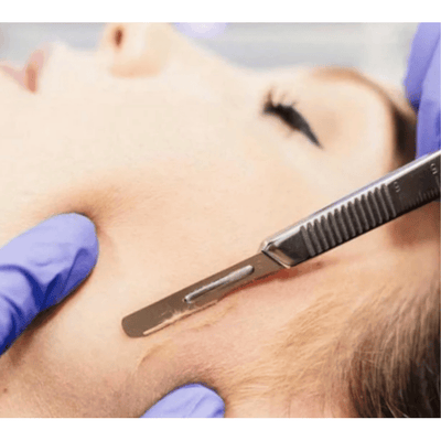 Swann Morton Dermaplanning Carbon Steel Blades 10 (10pcs)