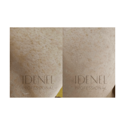 IDENEL - PEPTAXEL (Anti-aging "Purple" + Brightening "Yellow" Package: 10 Vials - 5 Vials of 1g + 5 Vials of 8ml)