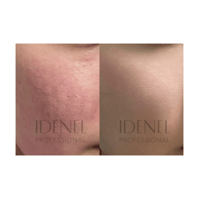 IDENEL - Revitalizing Nourishing Cream (10ml x 2)