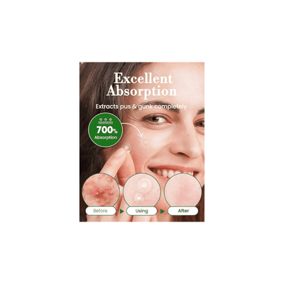 Invisible Pimple Spot Patch - 96 patches