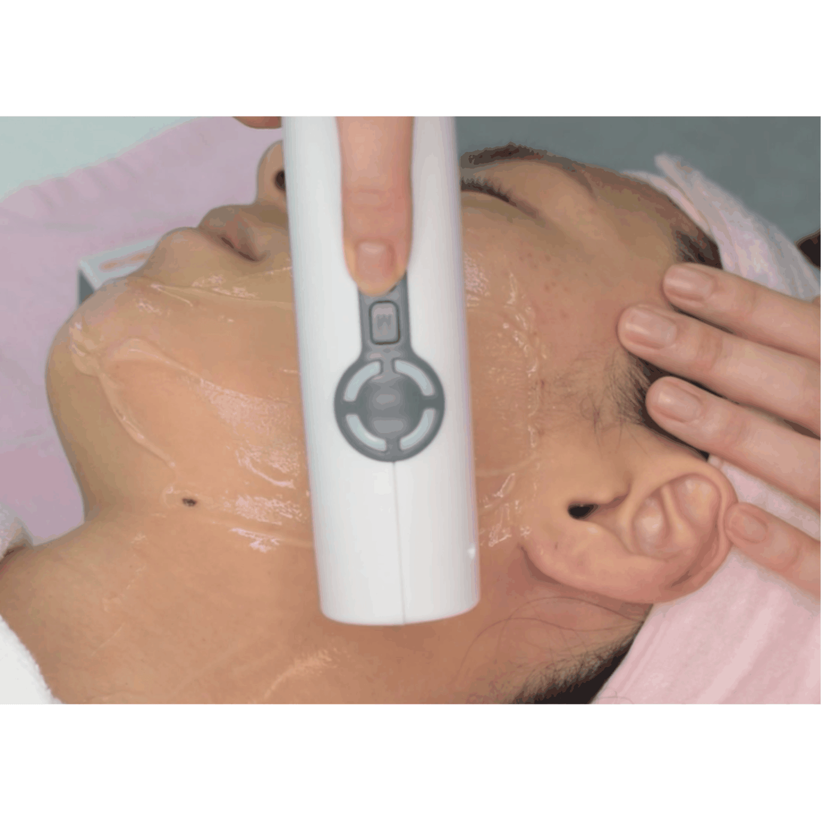Handheld HIFU Device