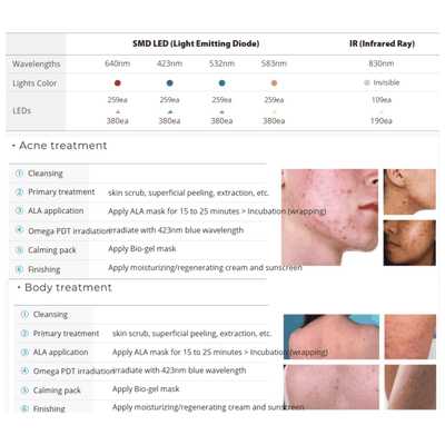 OMEGA PDT + IR Therapy System (3rd Generation)