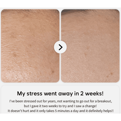 PRITTI - Cold Plasma Handheld Device