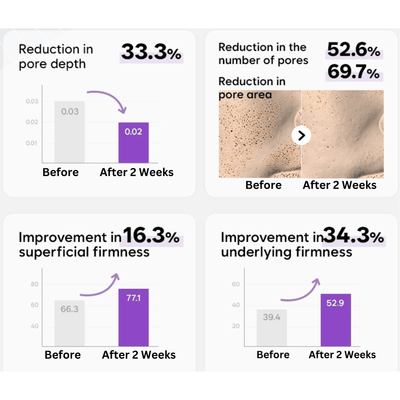 PRITTI - Cold Plasma Handheld Device