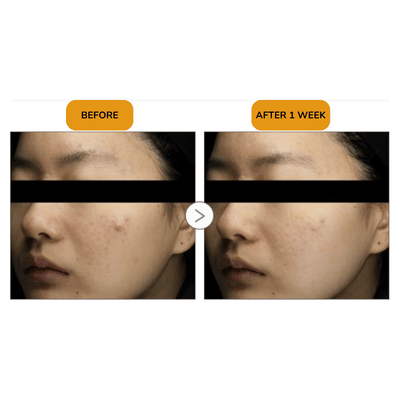 Soothing Repair Emulsion R4 - 120ml