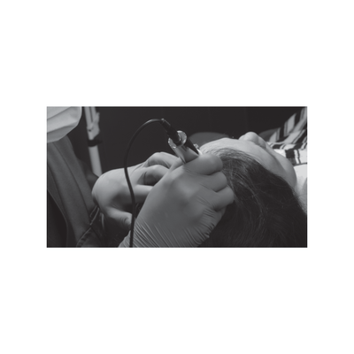 Staccato - Scalp Micropigmentation (SMP) Machine (Single Engine)