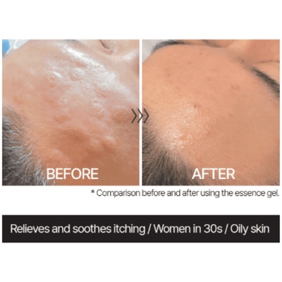 TUPS - Essence Gel - 200ml - Dermafirm USA