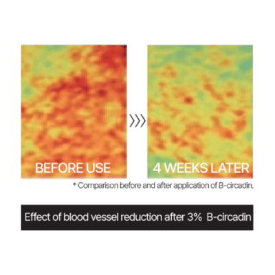 TUPS - M-GF Ampoule (7ml x 4ea + dropper 2pcs) - Dermafirm USA