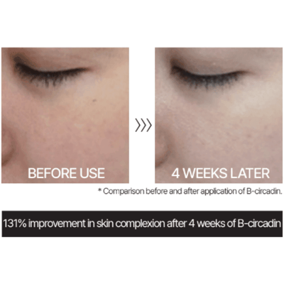 TUPS - M-GF Ampoule (7ml x 4ea + dropper 2pcs) - Dermafirm USA