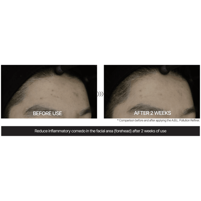 TUPS - A.B.L Pollution Refiner for Acne - Dermafirm USA