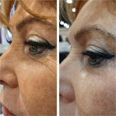 BIOTOC REGEN Serum - 5-Pack of 10ml (each) - Dermafirm USA