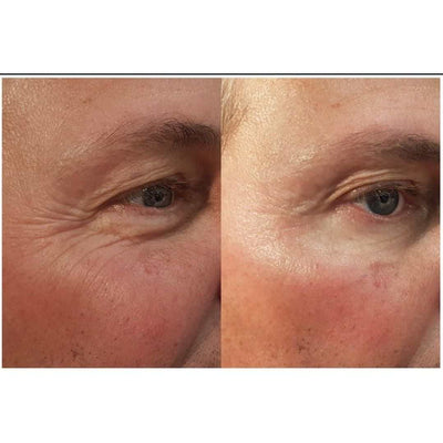 BIOTOC REGEN Cream - 50g - Dermafirm USA