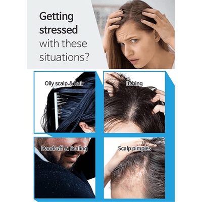 BallVic SEBO Shampoo - 230g - Dermafirm USA