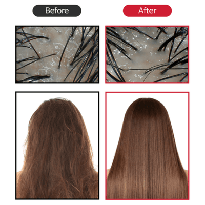 BallVic - Hair Pack Conditioner - 200g - Dermafirm USA