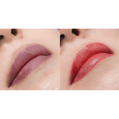 Staccato - Scalp Micropigmentation (SMP) Machine - Dermafirm USA