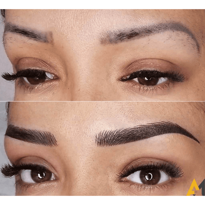 Staccato - Scalp Micropigmentation (SMP) Machine - Dermafirm USA