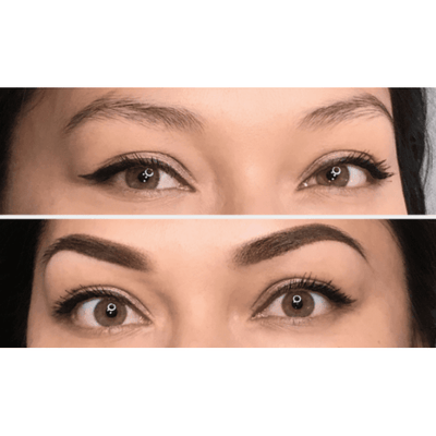 Staccato - Scalp Micropigmentation (SMP) Machine - Dermafirm USA