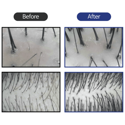 BallVic "S" Solution for Men - 50g - Dermafirm USA