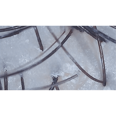 A.Tracer X - Scalp and Skin Detector & Analyzer - Dermafirm USA