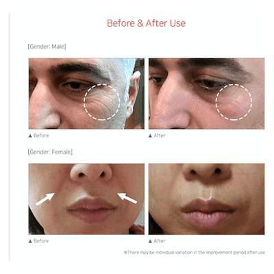 EPUS-Pro - Dermafirm USA