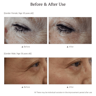 BIOTOC REGEN Serum - 5-Pack of 10ml (each) - Dermafirm USA