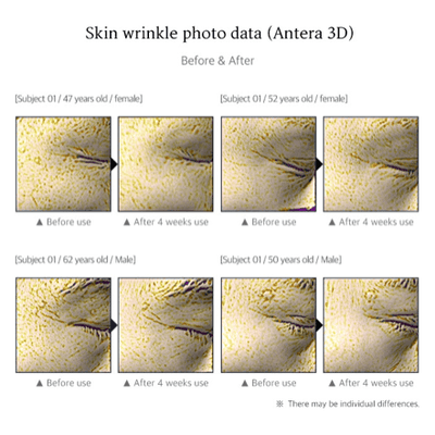 BIOTOC REGEN Serum - 5-Pack of 10ml (each) - Dermafirm USA