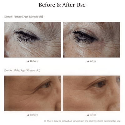 BIOTOC REGEN Cream - 50g - Dermafirm USA