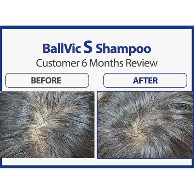 BallVic "S" Shampoo for Men - 230g - Dermafirm USA