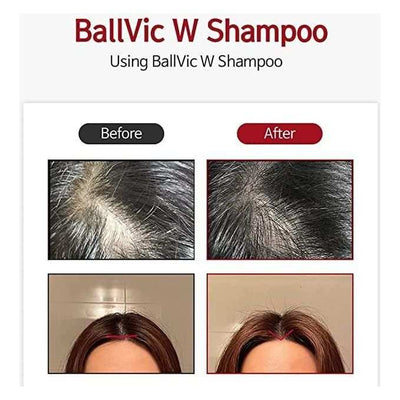 BallVic "W" Shampoo for Women - 230g - Dermafirm USA