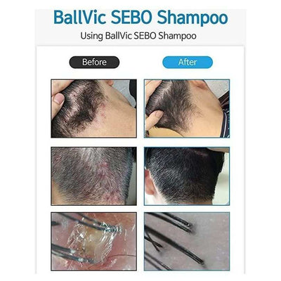 BallVic SEBO Shampoo - 230g - Dermafirm USA