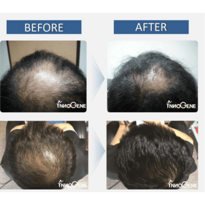 BallVic - Rainbow Pack (7 x 100g bottles) for Professionals - Dermafirm USA