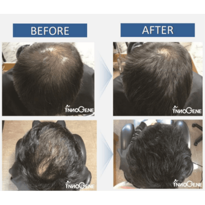 BallVic - Rainbow Pack (7 x 100g bottles) for Professionals - Dermafirm USA