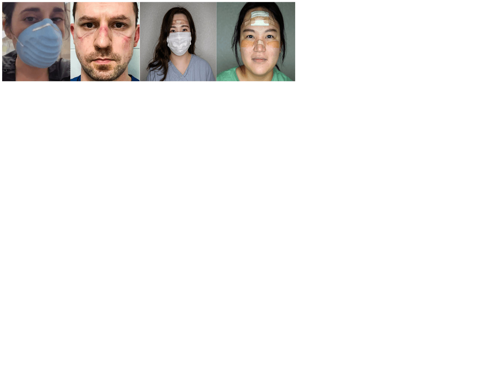 Skin Issues When You're Wearing a Mask - Dermafirm USA