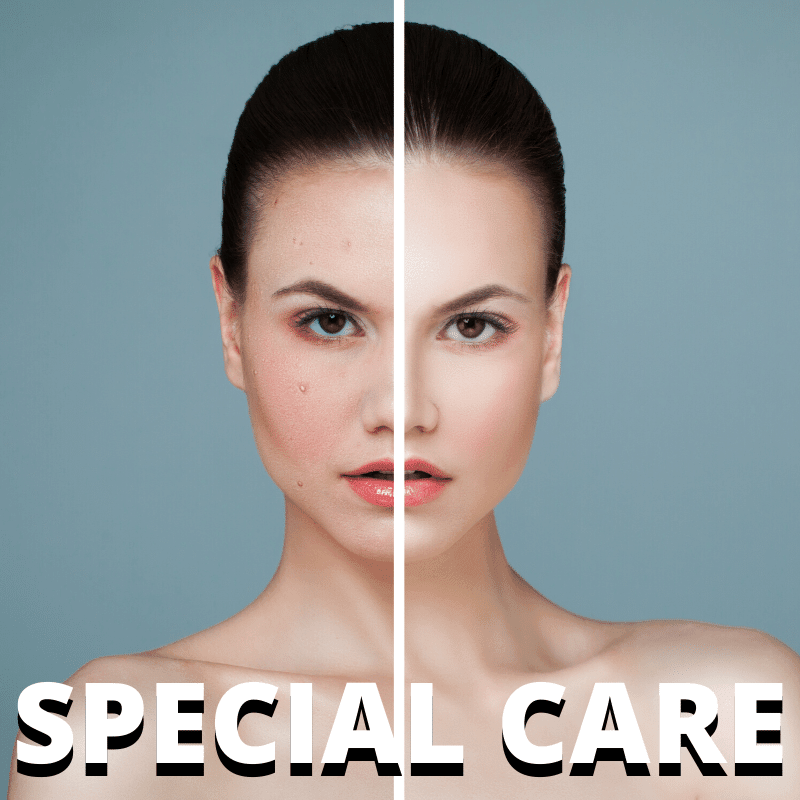 Special Care