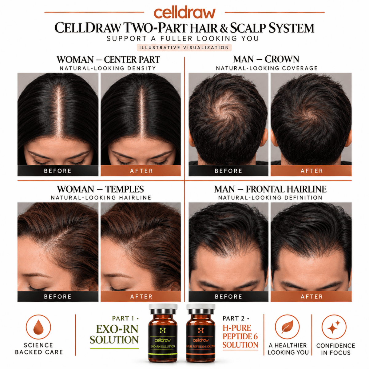 Professional Scalp Renewal Duo - 5ml x 20 vials