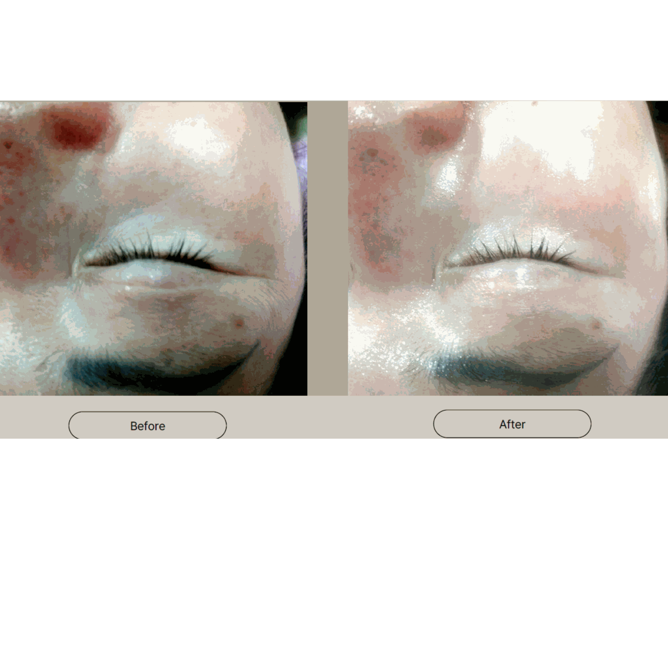 Whitening Spot Cream - 25g